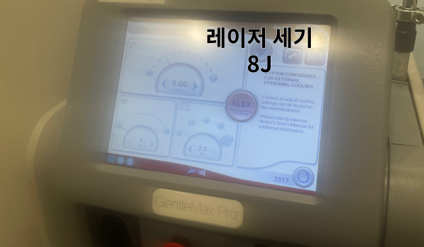 수염 레이저 제모 강남 피부과 16 젠틀맥스 프로