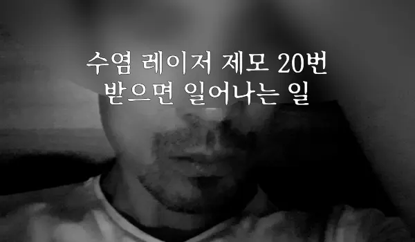 수염 레이저 제모 20번 후기