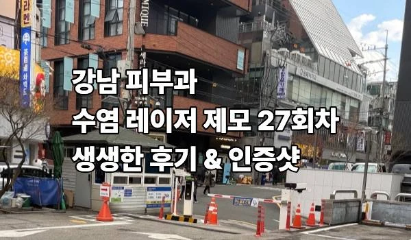 수염 레이저 제모 후기 27회차